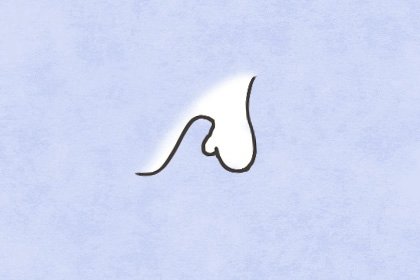 贫穷痣好还是不好(贫穷痣代表什么意思)插图