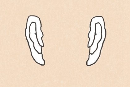 男孩额头上长痣能点黑痣吗(男人印堂黑痣正宗美人痣)插图