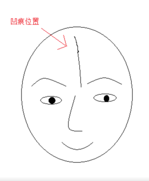 额头平眉心高代表什么 眉心高有什么讲究插图