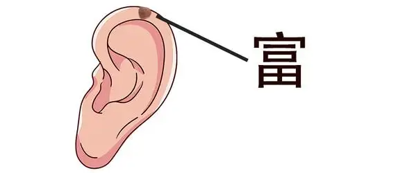 耳朵正下方有痣面相 耳朵有痣代表什么耳内有痣会长寿插图