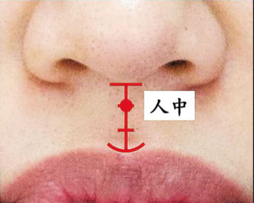 女人人中没有凹陷代表什么 人中浅平的女人好吗插图
