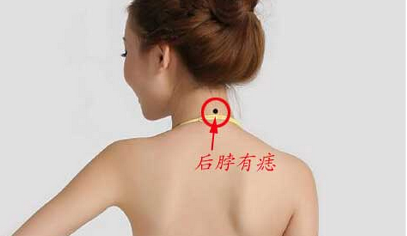 有苦情痣的男女有缘吗 女生有苦情痣好么插图