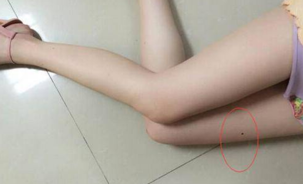 右小腿上有痣的各个部位详细图 女人脖子前右侧有痣的分析图插图