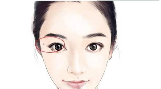 右眼太阳穴前方有痣代表什么 左右手都长痣有什么含义插图