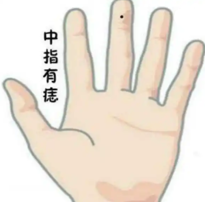 无名指与中指缝之间有痣 中指有痣的女人好吗插图