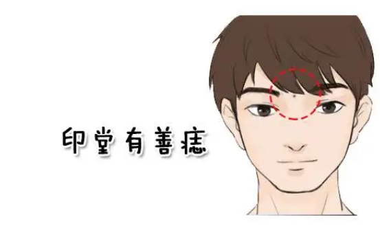 后脑勺长痣的男人代表什么 后脑勺有痣的男人意味着什么插图