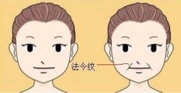 法令纹在脸上哪个部位 法令纹深好还是浅好插图