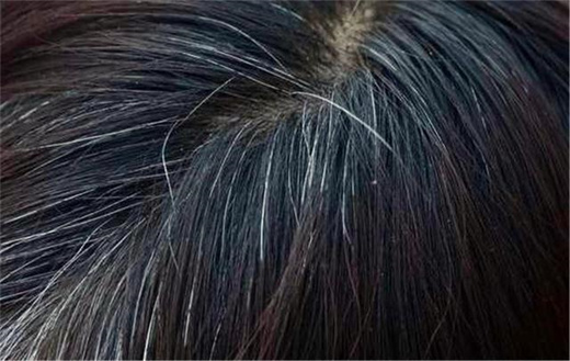 梦见长白头发是什么意思 梦见长出白头发的梦境解析插图