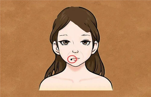 祛痣有什么风水讲究吗哪个部位的不能点插图1