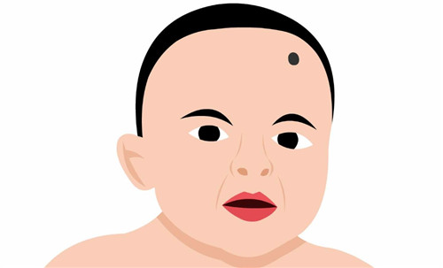 额头上后天长痣寓意什么 额头后天长痣是好还是不好插图1